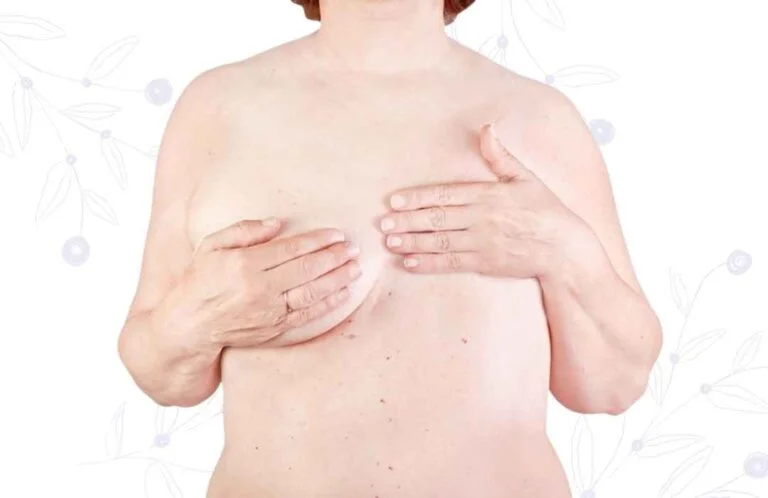 Reconstrucción Mamaria