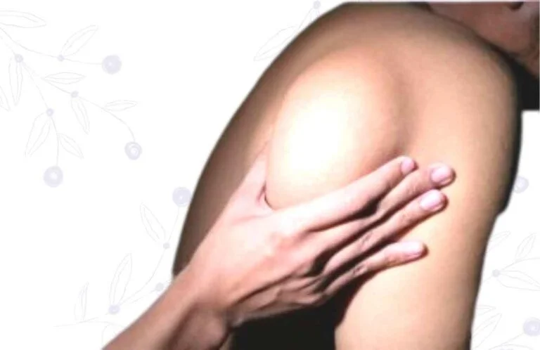 Reconstrucción por tumores de piel